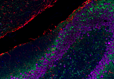 Small Size, Big Impact: Uncovering the Advantages of Nanobodies