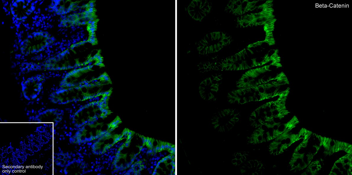 Beta Catenin Recombinant Antibody - Rat IgG1 (Chimeric)