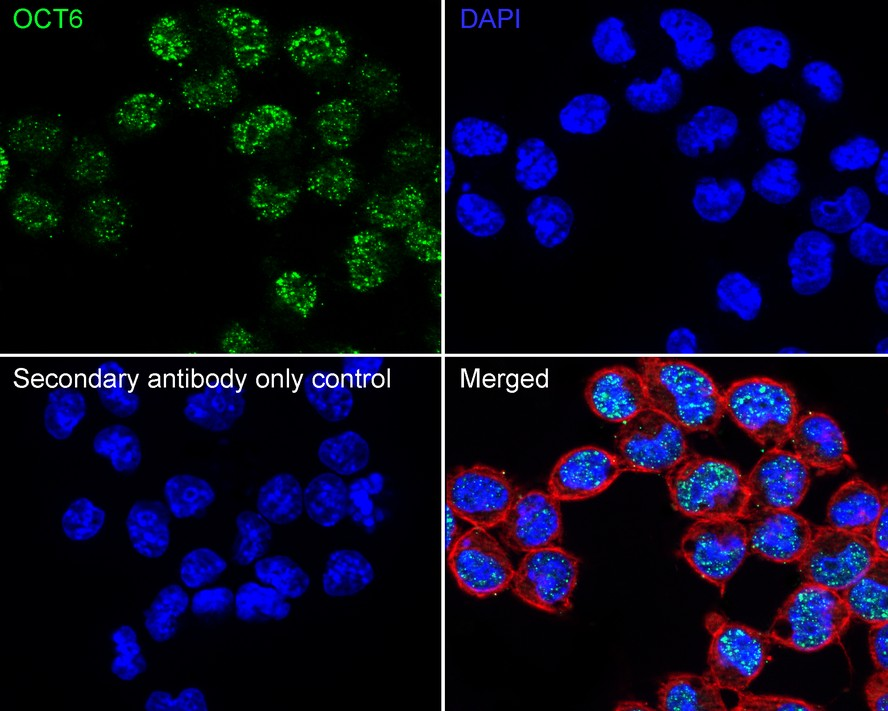 Oct6 Recombinant Rabbit Monoclonal Antibody [PSH20-48]