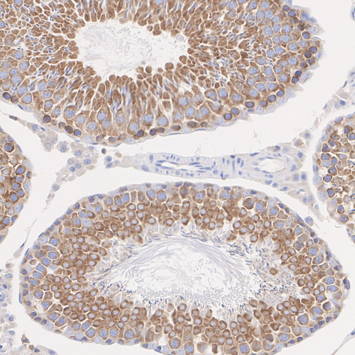 WNK1 Recombinant Rabbit Monoclonal Antibody [PSH20-74]