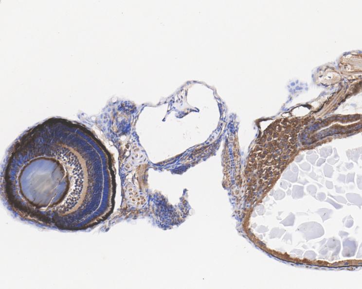 NF-kB p65 Rabbit Polyclonal Antibody