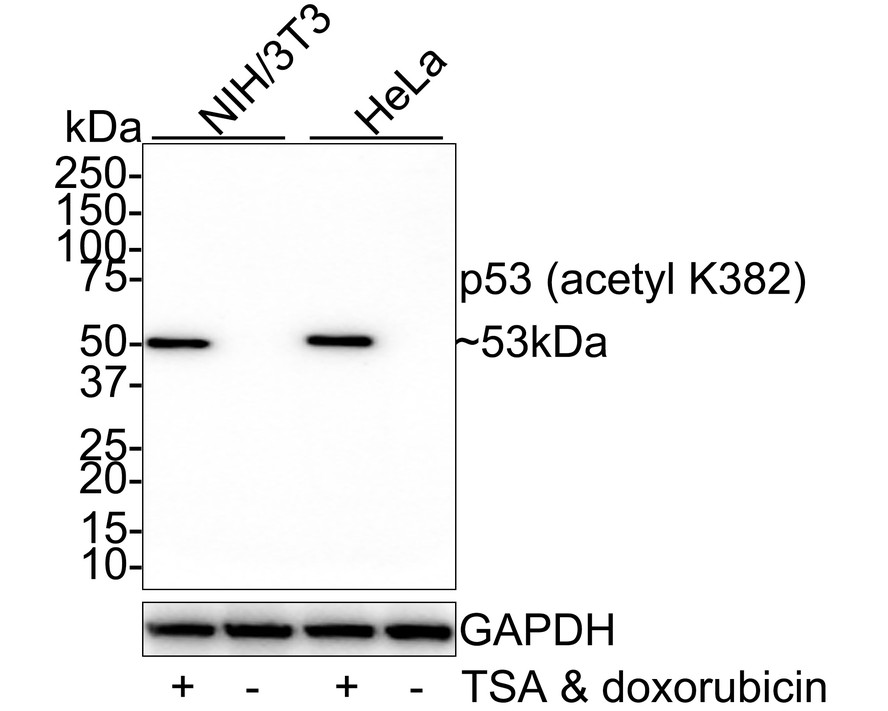 p53 (acetyl K382) Recombinant Rabbit Monoclonal Antibody