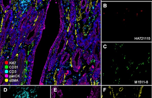 Small Size, Big Impact: Uncovering the Advantages of Nanobodies