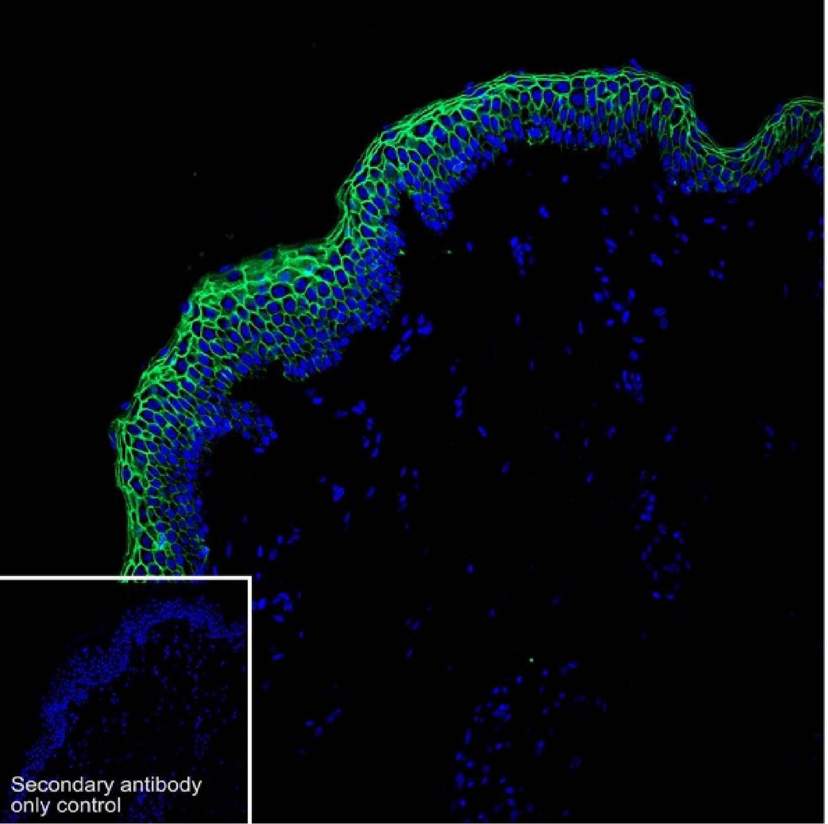 TROP2 Recombinant Rabbit Monoclonal Antibody [PSH22-14]
