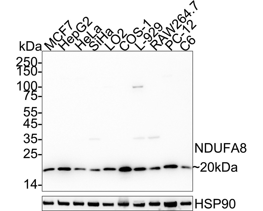 NDUFA8 Recombinant Rabbit Monoclonal Antibody [PSH21-96]