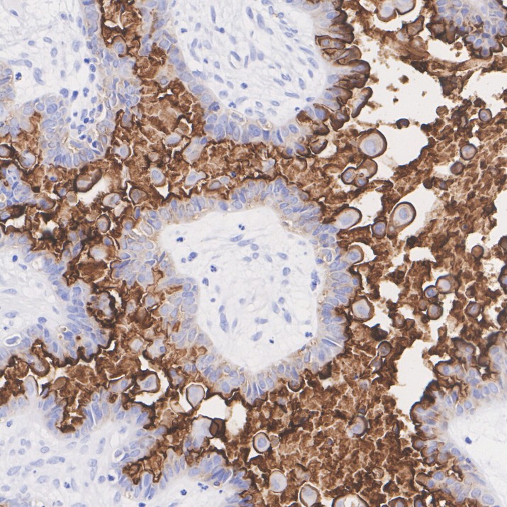 MUC16 Recombinant Rabbit Monoclonal Antibody [PSH21-77]