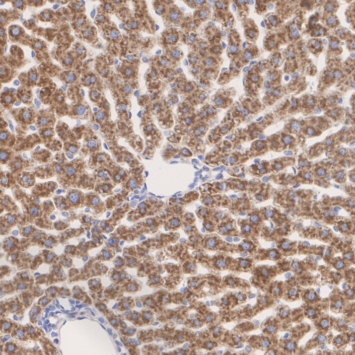 CerS2 Recombinant Rabbit Monoclonal Antibody [PSH25-62]