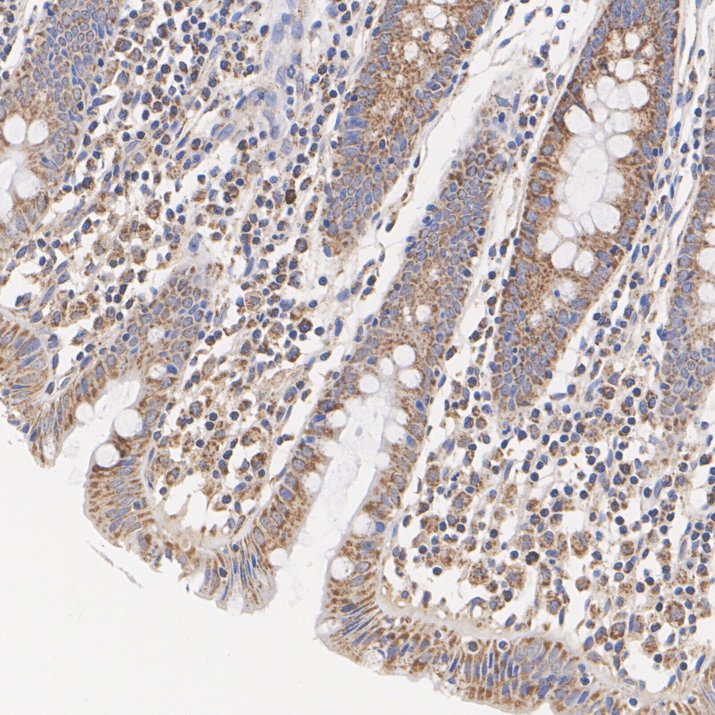 LONP1 Recombinant Rabbit Monoclonal Antibody [PSH28-77]