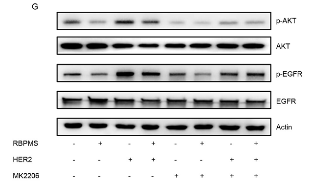 36423381 ET1701-80.png