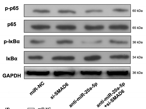 35917232 ET1603-12.png