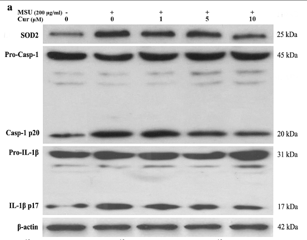 31455356 ET1701-39.png