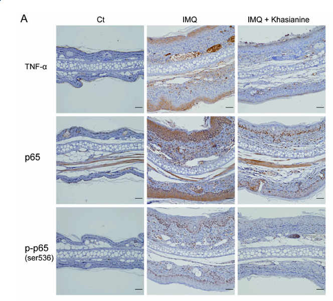 35183690 ET1603-12 IHC.png