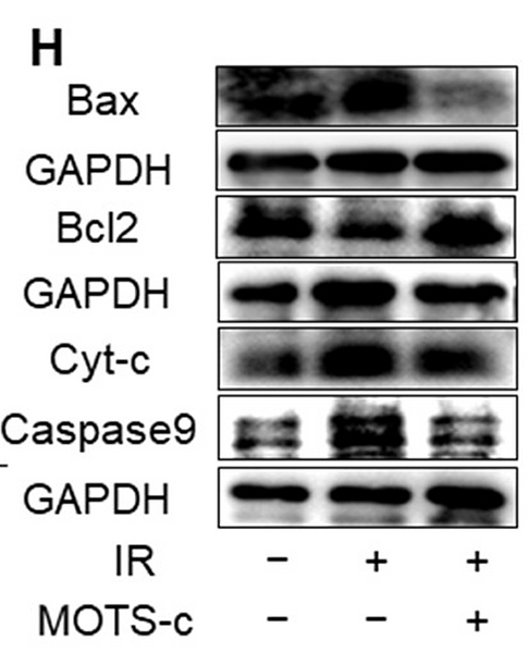 Zhang Yanli,et al-4.png