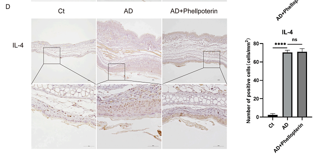 36179418 ER1706-55.png