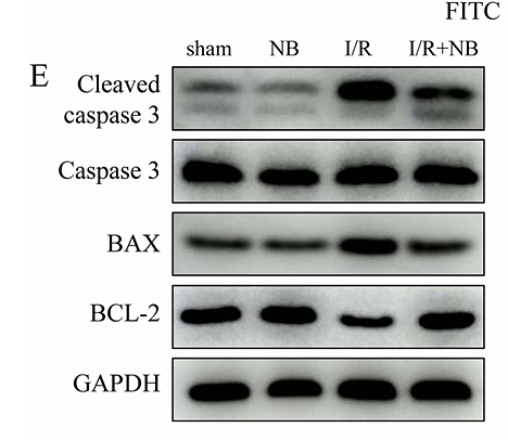 Yu Qiwen,et al-1.png