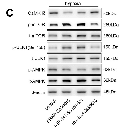 35597494 ET1704-63.png