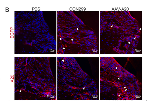 35714941 ER65678.png