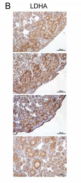 35525303 ET1608-57 IHC.png