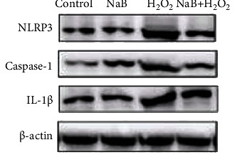 35132348 ET1701-39.tif
