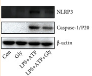 35185385 EM21002.tif