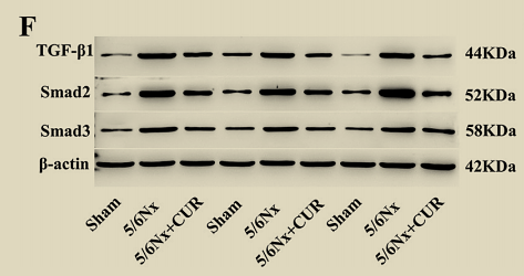 2025年1月-ET1607-41-Smad 3.png