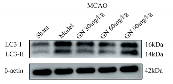 36634381 ET1701-65.png