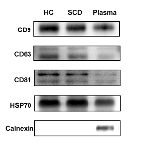 36723013 ET1611-86.png