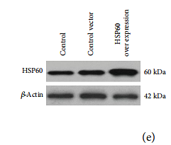 33488933 ET1609-45.png