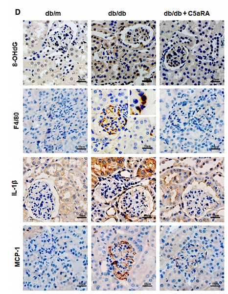 33280239-IL-1 β.png