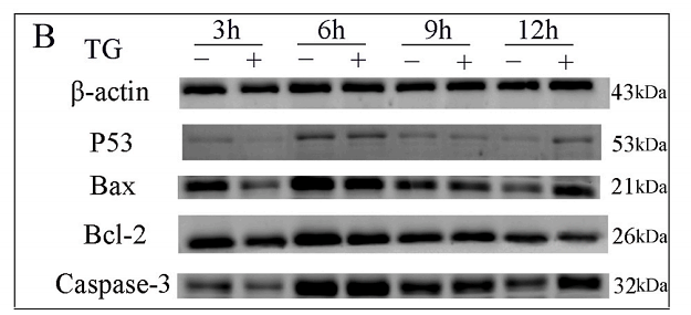 36403802 ER30804.png