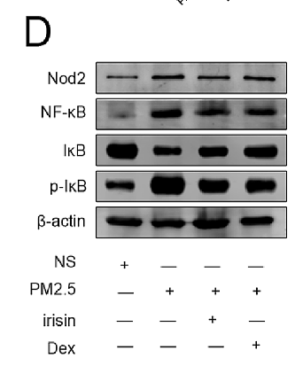 37003140 ET1603-12.png