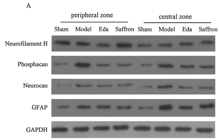 32113053 ET1601-23.png