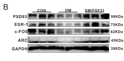 35761156 ET1705-90.png