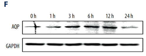 32491998 ET1601-4.png