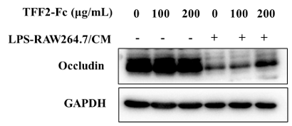 37129719 ET1601-4.png