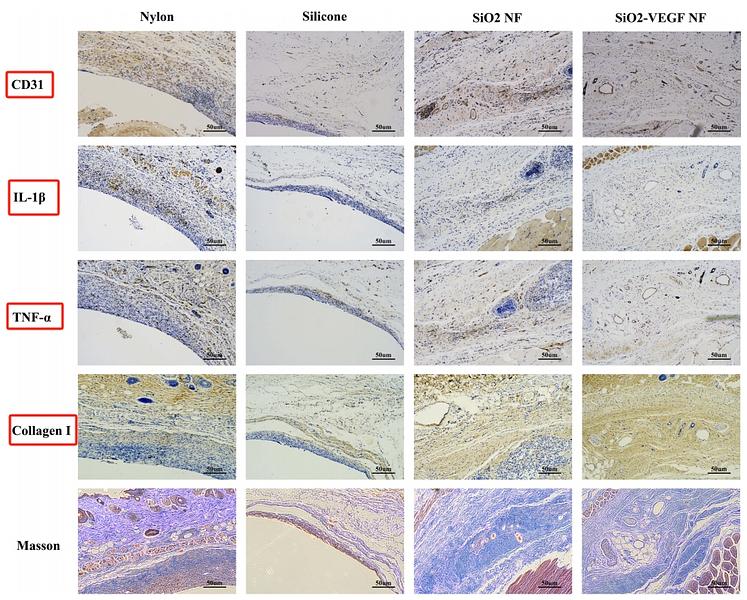 32095072 ET1609-68.jpg