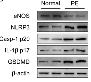 36508916 ER1905-47.png