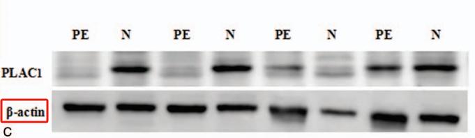 31689783 EM21002.jpg